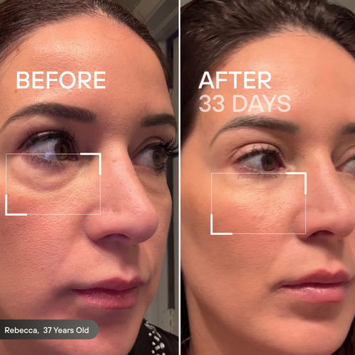 Skeye - Therapy Eye Glasses