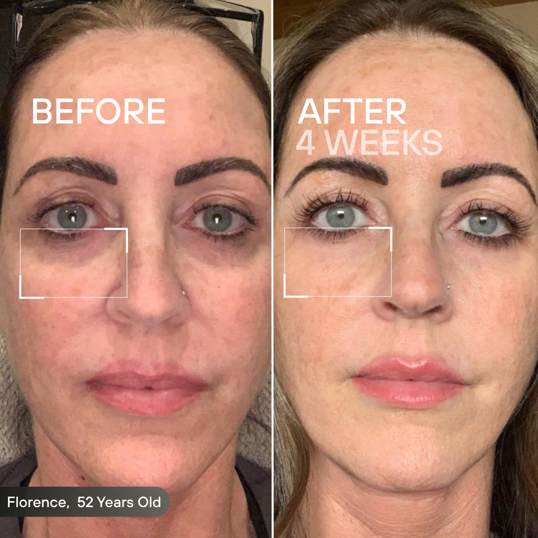 Skeye - Therapy Eye Glasses