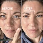 Skeye - Therapy Eye Glasses