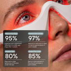 Skeye - Therapy Eye Glasses